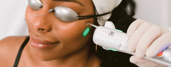 Laser Hair Removal in Prime