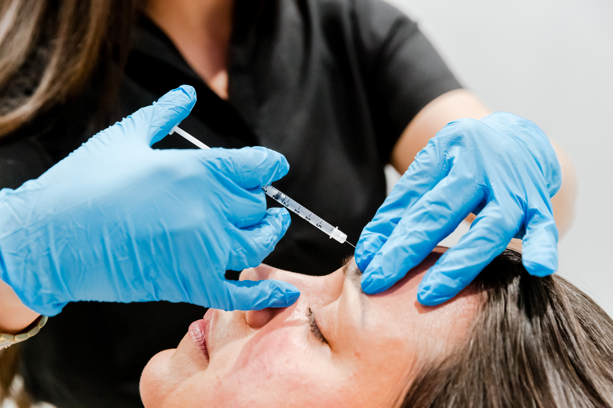 botox in reston