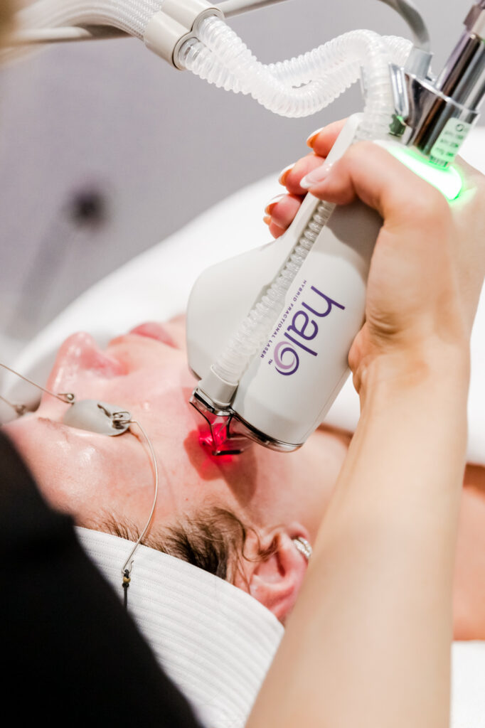 laser resurfacing in Arlington