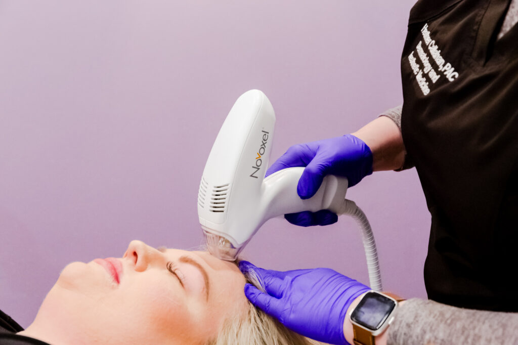 Laser Treatments for Skin Rejuvenation in Vienna, VA