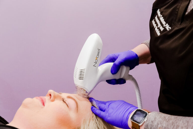 Laser Treatments for Skin Rejuvenation in Vienna, VA