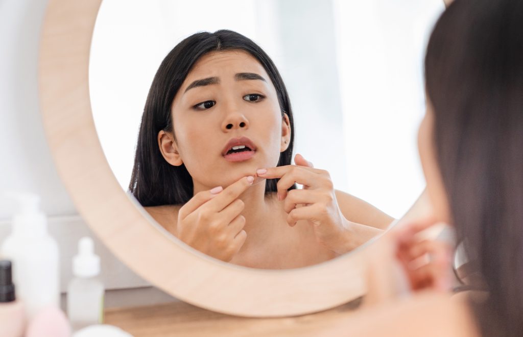 Restore Your Confidence with Advanced Acne Scar Treatment in Northern Virginia
