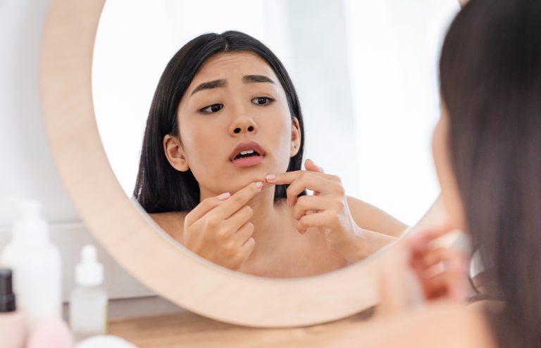 Restore Your Confidence with Advanced Acne Scar Treatment in Northern Virginia