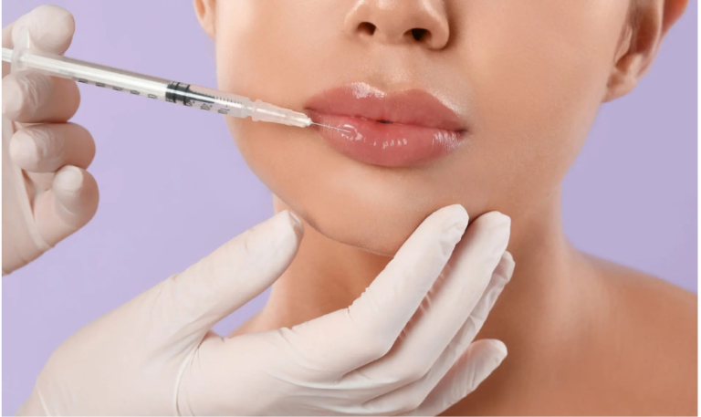 Dermestetics Lip Injections in Northern Virginia